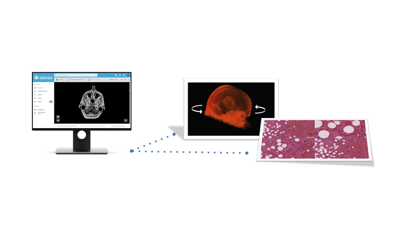 Idonia Viewer Pro — TAC de cráneo, reconstrucción 3D y anatomía patológica en pantalla